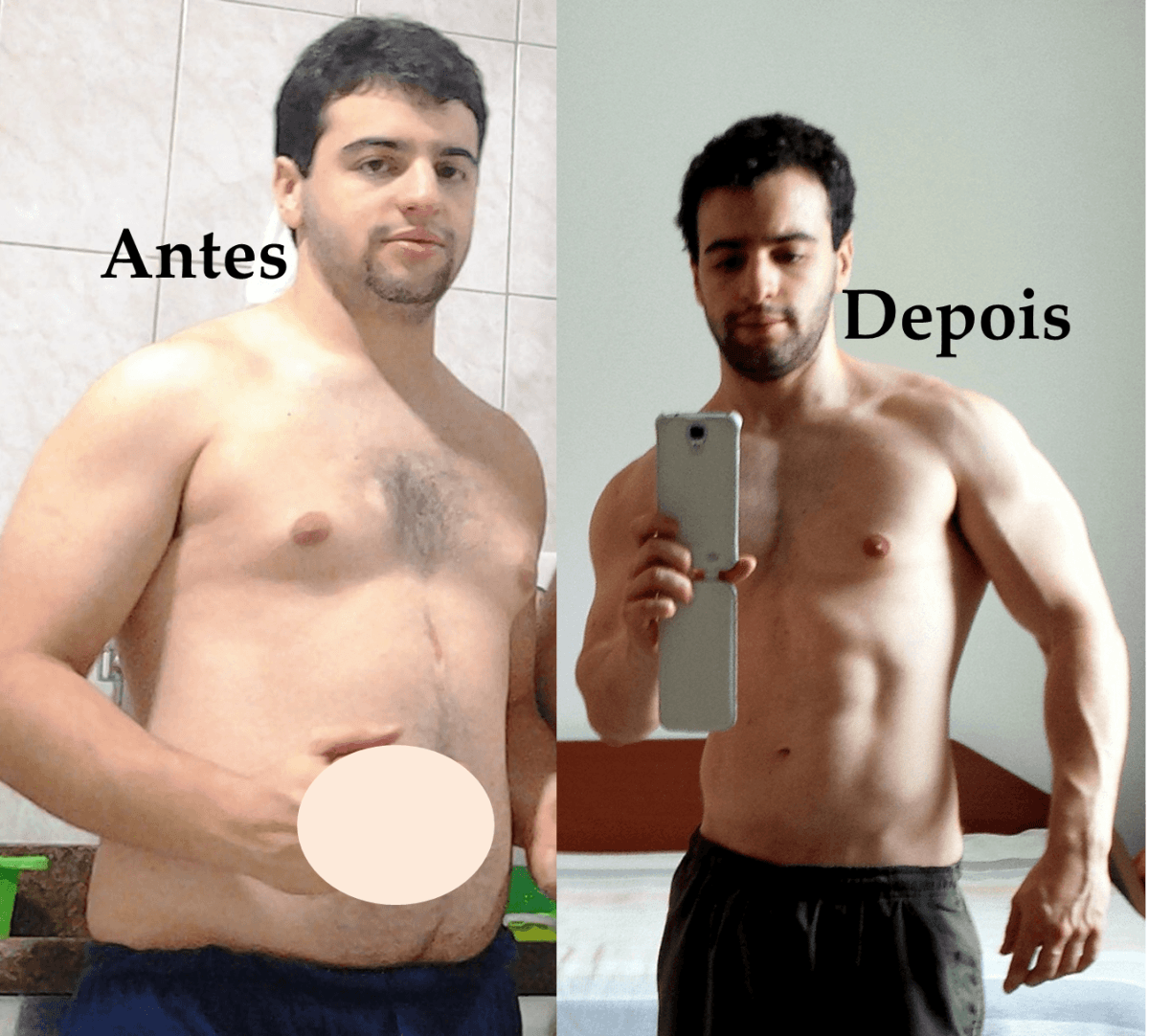 antes e depois guilherme