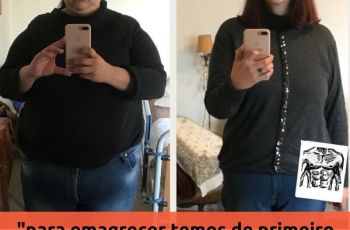 Priscilla: Da Obesidade Mórbida Ao Equilibrio