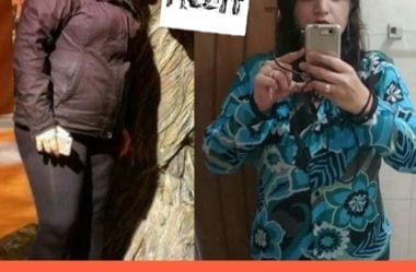 Patricia Elimina 50kg Com Dieta Cetogenica E Resolve Se Tornar Carnivora